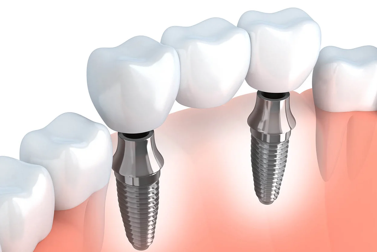 Kamal Dental Clinic