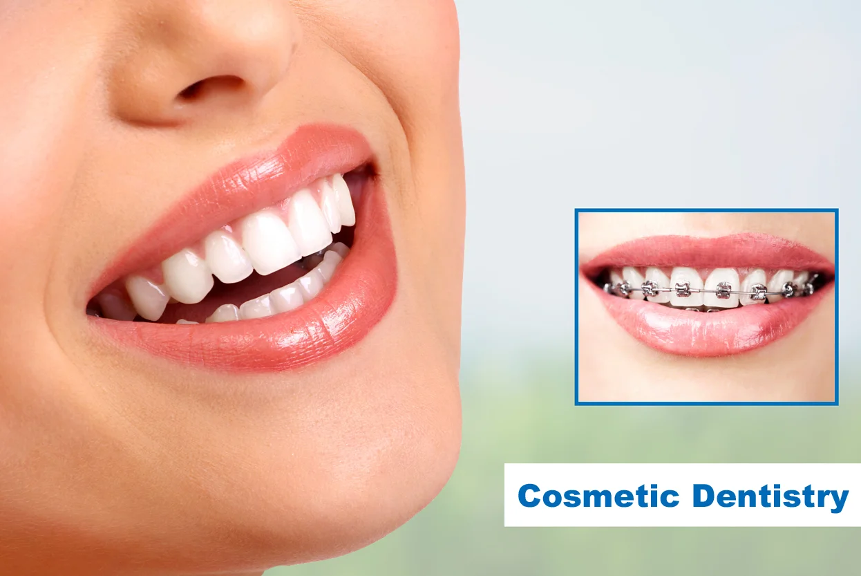 Cosmetic Dentistry