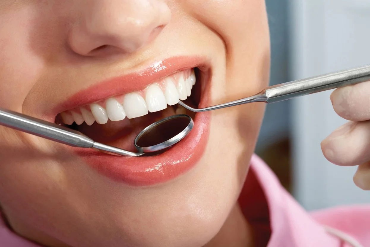 Teeth Scaling